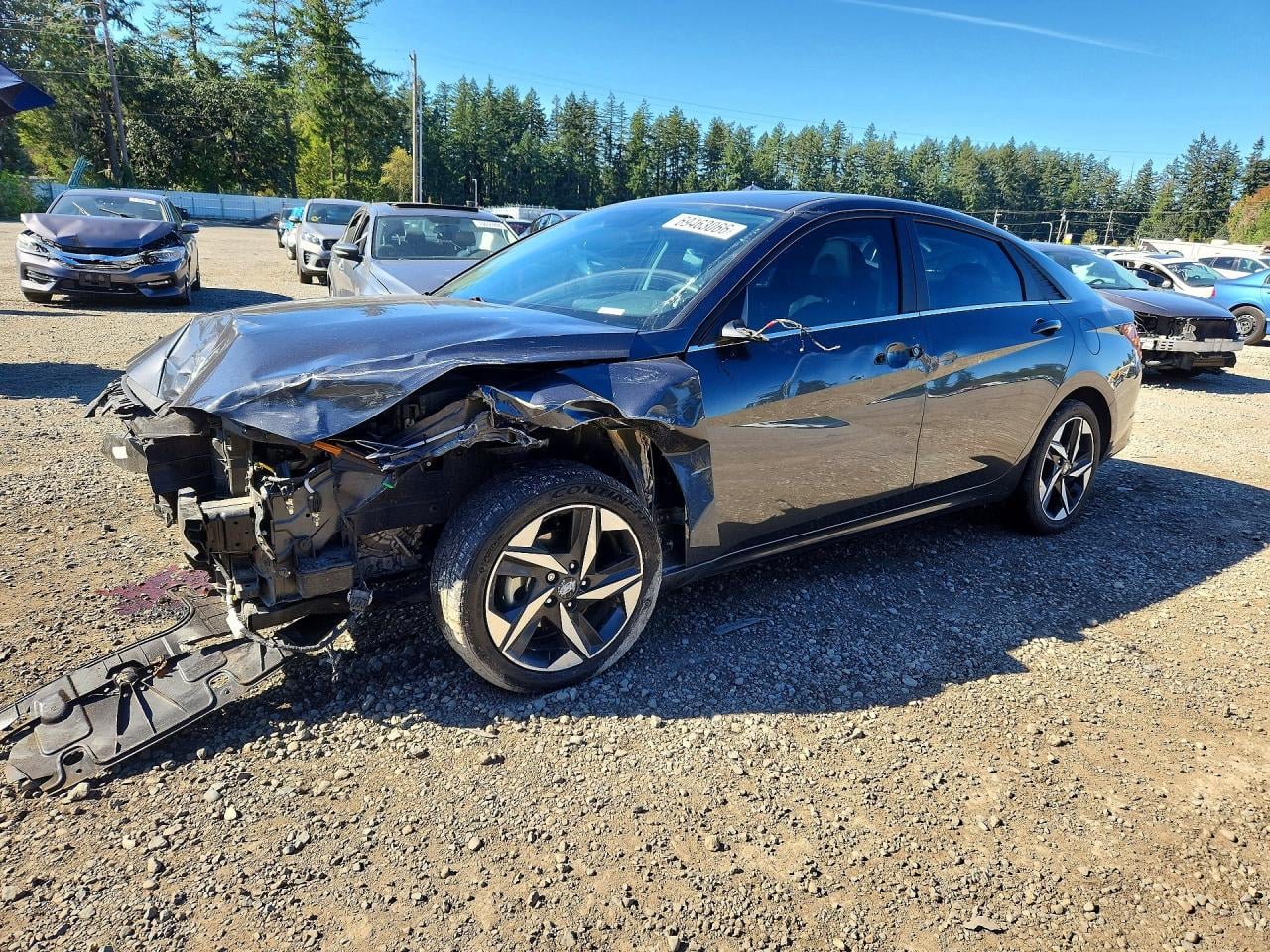 2021 HYUNDAI ELANTRA LIMITED | 5NPLP4AG0MH017353 | UPCARS