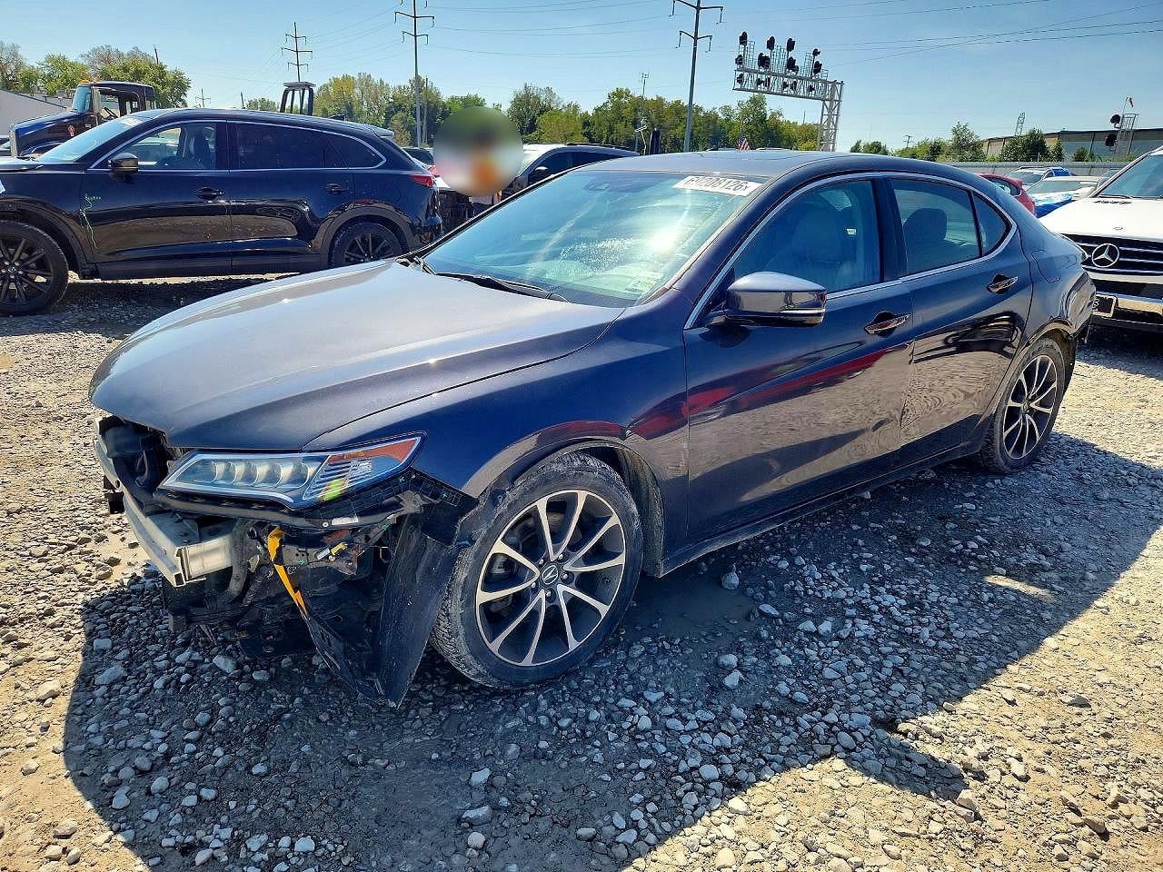 2015 ACURA TLX TECH | 19UUB2F52FA001391 | UPCARS